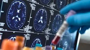 Cerebro