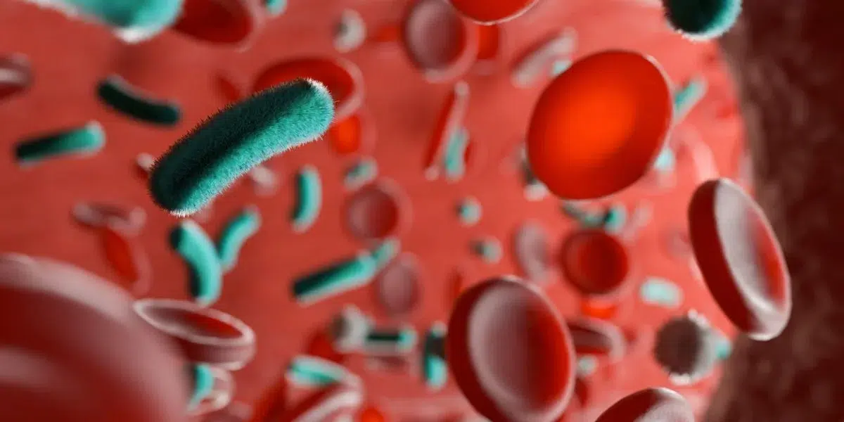 La inteligencia artificial busca reducir las nuevas muertes por sepsis. 1 Oregano va 22 1